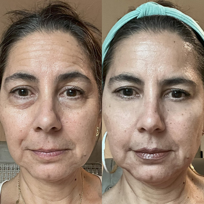 GlowEyes - Under-Eye Red Light Therapy