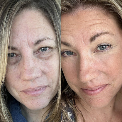 GlowEyes - Under-Eye Red Light Therapy